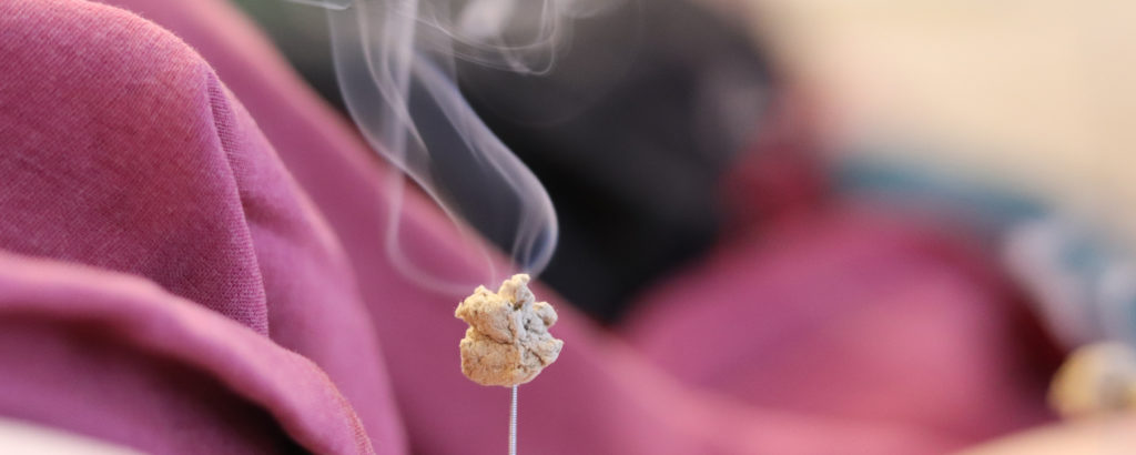 The burning of Moxa -- moxibustion -- on the tip of a needle is an important element of many acupuncture treatments